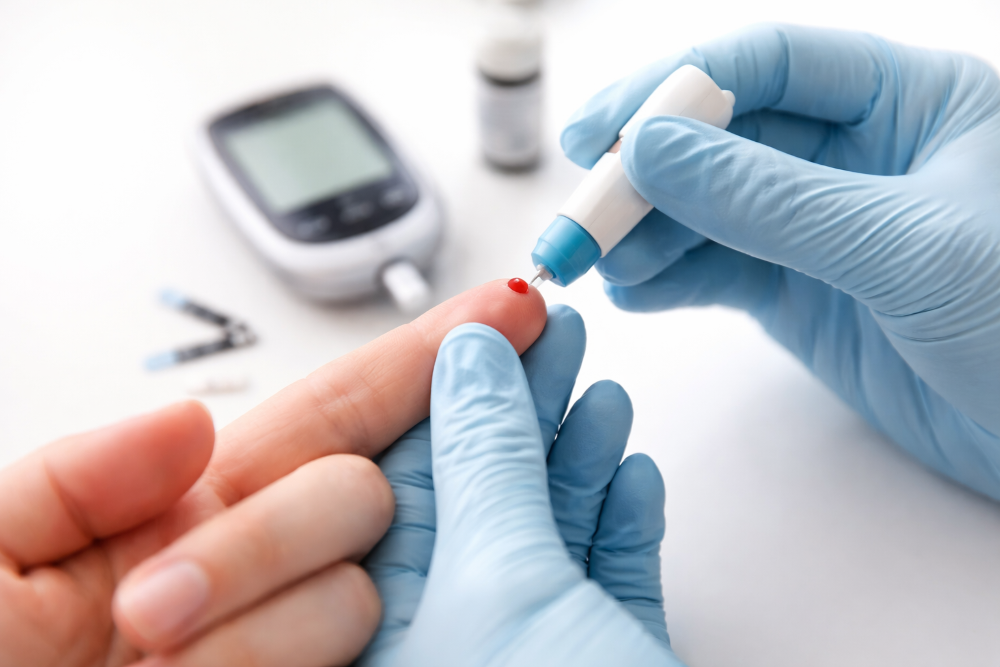 Pemeriksaan Asam Urat Secara Medis, Ini Pilihan Tes Darah dan Urine yang Perlu Diketahui